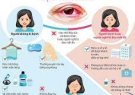 cách phòng bệnh đau mắt đỏ